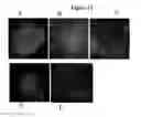 Fig. 10 - Generation of neural stem cells from undifferentiated human embryonic stem cells