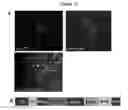 Fig. 16 - Generation of neural stem cells from undifferentiated human embryonic stem cells