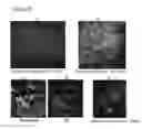 Fig. 28 - Generation of neural stem cells from undifferentiated human embryonic stem cells