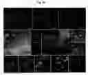 Fig. 33 - Generation of neural stem cells from undifferentiated human embryonic stem cells
