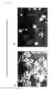 Fig. 06 - Method of making macrophage expressing an antibody directed against β-amyloid