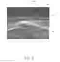 Fig. 04 - CULTURE MEDIUM AND HYDROPHILIC COMPOSITE THEREOF
