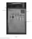 Fig. 07 - METHOD AND SYSTEM UTILIZING LATERAL FLOW IMMUNOASSAY TEST DEVICE WITH INTEGRATED QUALITY ASSURANCE LABEL