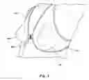 Fig. 04 -  BREAST SUPPORT ARRANGEMENT