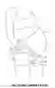 Fig. 01 - Single piece abdominal support garment