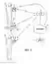 Fig. 02 - Weighing device and method