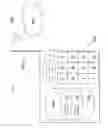 Fig. 04 - Call correcting relay system for optimizing call relaying between different telecommunication networks