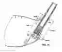 Fig. 09 - Golf club head