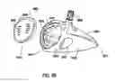 Fig. 37 - Golf club head