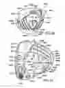Fig. 45 - Golf club head