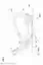 Fig. 03 - Iron-type golf club head