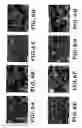 Fig. 06 - High surface area, electrically conductive nanocarbon-supported metal oxide