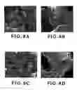 Fig. 08 - High surface area, electrically conductive nanocarbon-supported metal oxide