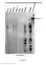 Fig. 06 - MATERIALS AND METHODS FOR DETERMINING SUBTELOMERE DNA SEQUENCE
