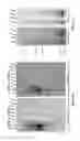 Fig. 23 - MATERIALS AND METHODS FOR DETERMINING SUBTELOMERE DNA SEQUENCE