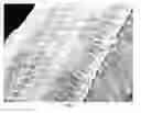 Fig. 04 - CELL LINE DERIVED FROM THE EPITHELIAL LINING OF THE HUMAN ENDOLYMPHATIC SAC IN THE INNER EAR