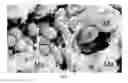 Fig. 06 - CELL LINE DERIVED FROM THE EPITHELIAL LINING OF THE HUMAN ENDOLYMPHATIC SAC IN THE INNER EAR