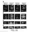 Fig. 07 - Agents and methods related to reducing resistance to apoptosis-inducing death receptor agonists