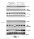 Fig. 09 - Agents and methods related to reducing resistance to apoptosis-inducing death receptor agonists