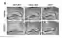 Fig. 01 - COMPOUNDS AND RELATED METHODS FOR MANIPULATING PARP-1-DEPENDENT CELL DEATH