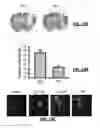 Fig. 19 - COMPOUNDS AND RELATED METHODS FOR MANIPULATING PARP-1-DEPENDENT CELL DEATH