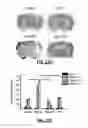 Fig. 20 - COMPOUNDS AND RELATED METHODS FOR MANIPULATING PARP-1-DEPENDENT CELL DEATH