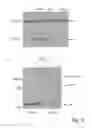 Fig. 06 - Methods for treatment of Alzheimer's disease