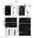 Fig. 07 - ACCELERATED EXTENSION OF AXONS