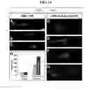 Fig. 15 - ACCELERATED EXTENSION OF AXONS