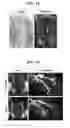 Fig. 16 - ACCELERATED EXTENSION OF AXONS