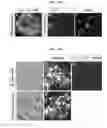 Fig. 18 - ACCELERATED EXTENSION OF AXONS