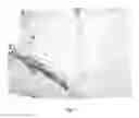 Fig. 07 - ANTI-AGING AGENT