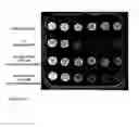 Fig. 04 - SCREENING MOLECULES WITH ANTI-PRION ACTIVITY: KITS, METHODS AND SCREENED MOLECULES