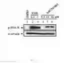 Fig. 03 - Heteroannelated anthraquinone derivatives for inhibiting cancers