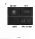 Fig. 08 - Heteroannelated anthraquinone derivatives for inhibiting cancers