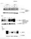 Fig. 15 - METHODS FOR INHIBITING ANGIOGENESIS WITH MULTI-ARM POLYMERIC CONJUGATES OF 7-ETHYL-10-HYDROXYCAMPTOTHECIN