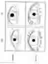 Fig. 02 - Method of enhancing hair growth