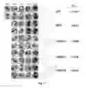 Fig. 20 - Small molecule inhibitors of Dusp6 and uses therefor