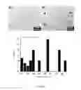 Fig. 11 - Oil-dispersible composite of metallic nanoparticle and method for synthesizing same