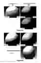 Fig. 08 - Additive for the crystallization of proteins, use and process