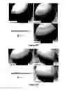 Fig. 09 - Additive for the crystallization of proteins, use and process