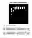 Fig. 05 - Plasmid DNA extraction process