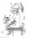 Fig. 03 - Stabilizer for robotic beating-heart surgery