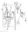 Fig. 11 - Stabilizer for robotic beating-heart surgery