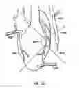 Fig. 12 - Stabilizer for robotic beating-heart surgery