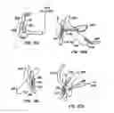 Fig. 16 - Stabilizer for robotic beating-heart surgery