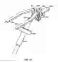 Fig. 18 - Stabilizer for robotic beating-heart surgery