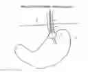 Fig. 01 - METHODS AND APPARATUS FOR TESTING DISRUPTION OF A VAGAL NERVE