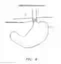 Fig. 06 - METHODS AND APPARATUS FOR TESTING DISRUPTION OF A VAGAL NERVE