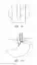 Fig. 09 - METHODS AND APPARATUS FOR TESTING DISRUPTION OF A VAGAL NERVE